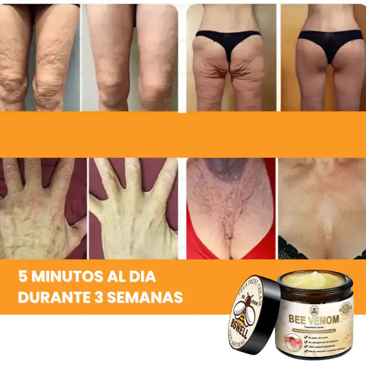 🐝✨Crema Reafirmante con Veneno de Abeja – ¡Despídete de la piel flácida!✨🐝