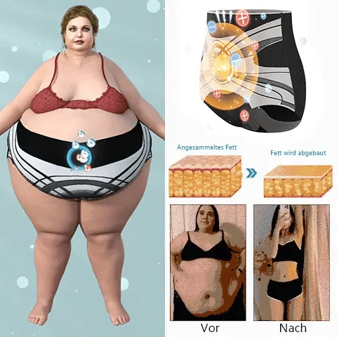 🩱 Shorts Moldeadores Anyidea® de Fibra de Titanio Médica y Turmalina ✨