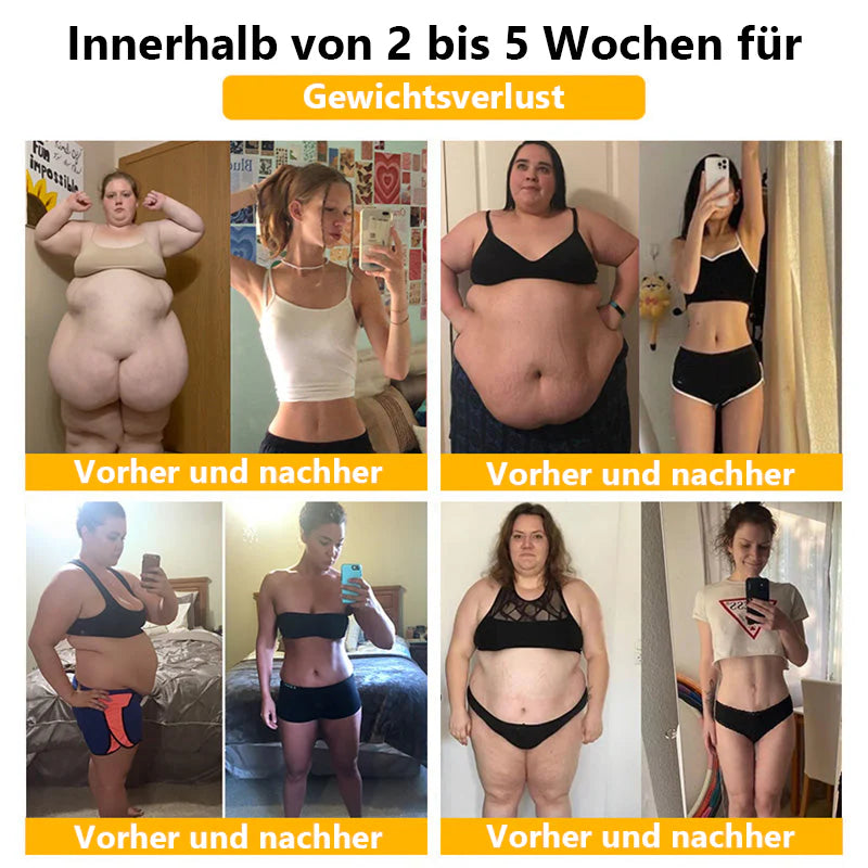 🩱 Shorts Moldeadores Anyidea® de Fibra de Titanio Médica y Turmalina ✨