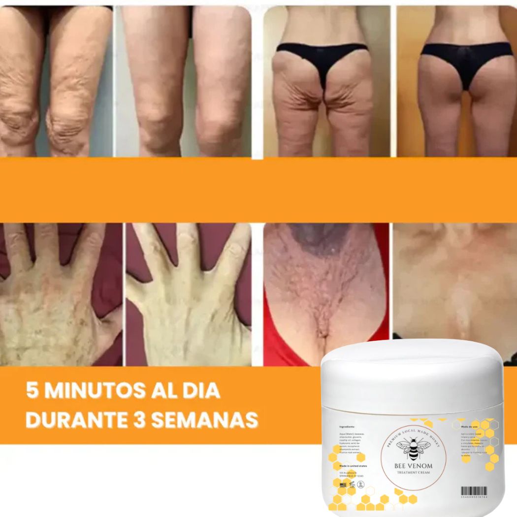 🐝✨Crema Reafirmante con Veneno de Abeja – ¡Despídete de la piel flácida!✨🐝