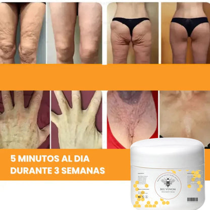 🐝✨Crema Reafirmante con Veneno de Abeja – ¡Despídete de la piel flácida!✨🐝