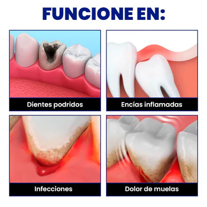 🦷 Spray Alivio Dolor de Muelas — Solución Dental Analgésica