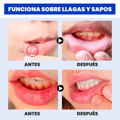 🦷 Spray Alivio Dolor de Muelas — Solución Dental Analgésica